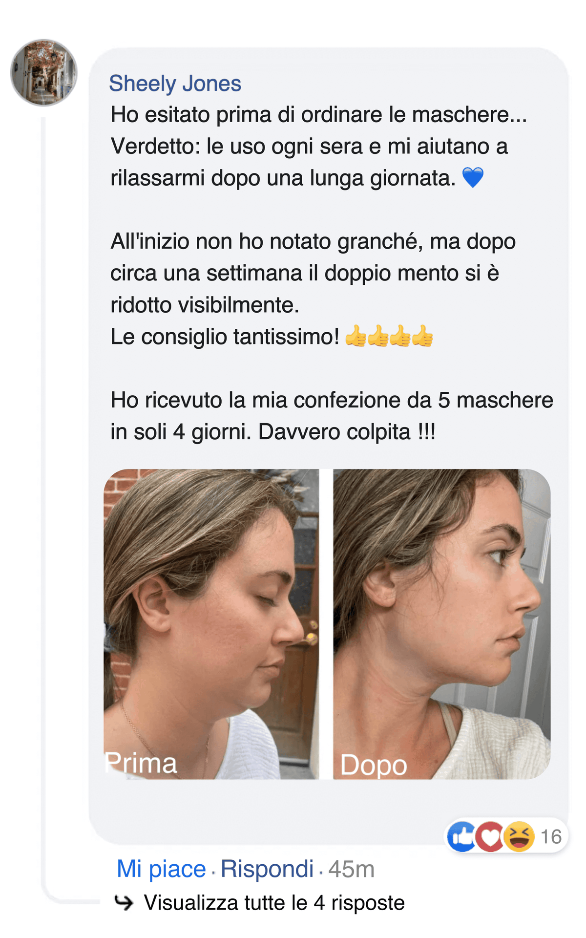 Foto di profilo prima e dopo: doppio mento ridotto con le maschere.