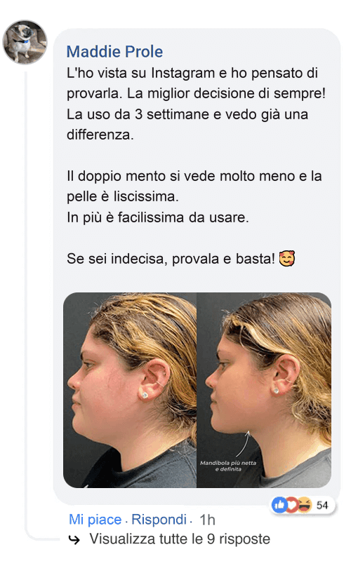 Confronto affiancato di profili del viso: linea della mandibola migliorata.
