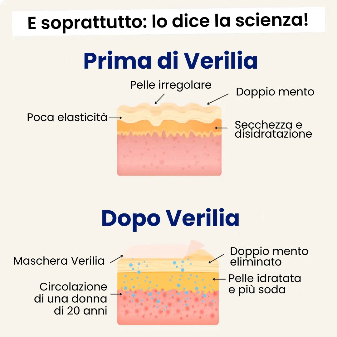 Verilia Lift (nuova versione)