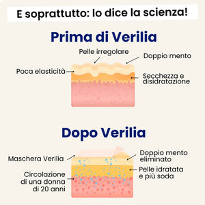 Verilia Lift (nuova versione)