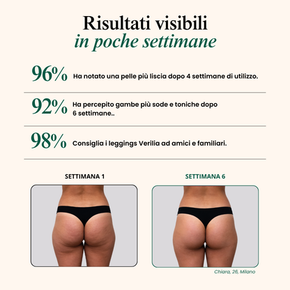 3D Anti-Cellulite Leggings