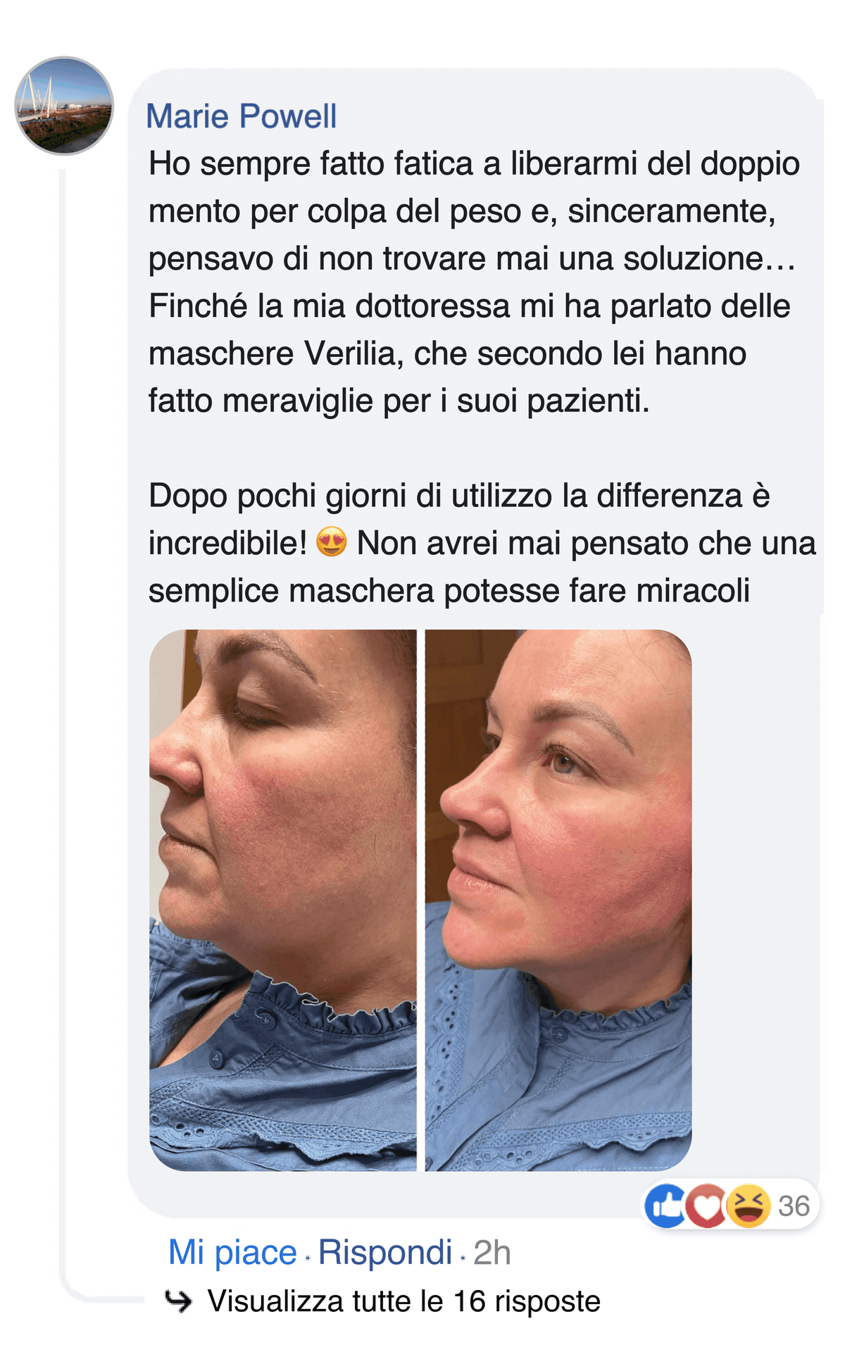 Confronto affiancato del viso di una donna prima e dopo l'uso del prodotto.
