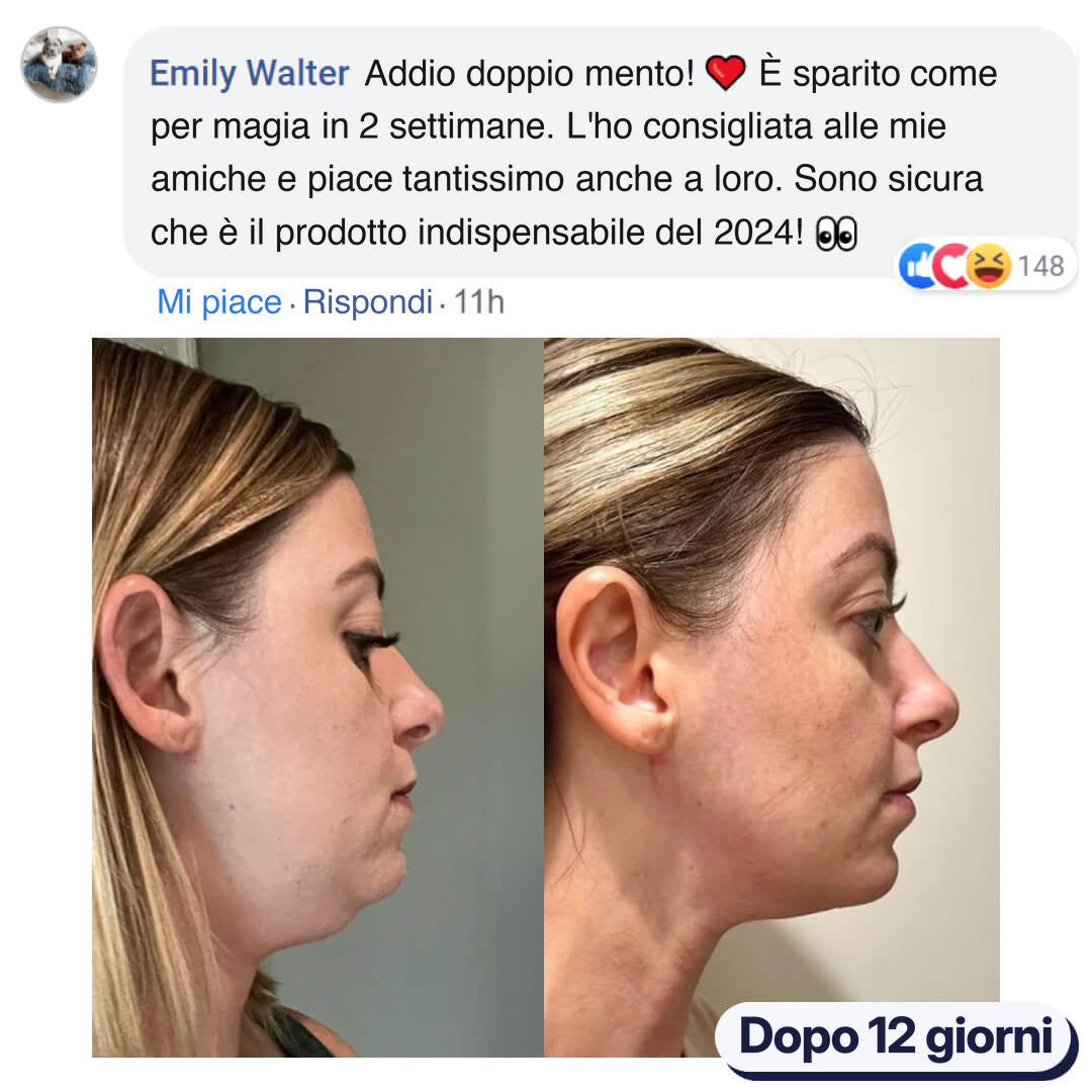 Foto prima e dopo di una donna: mento meno pieno dopo 12 giorni.