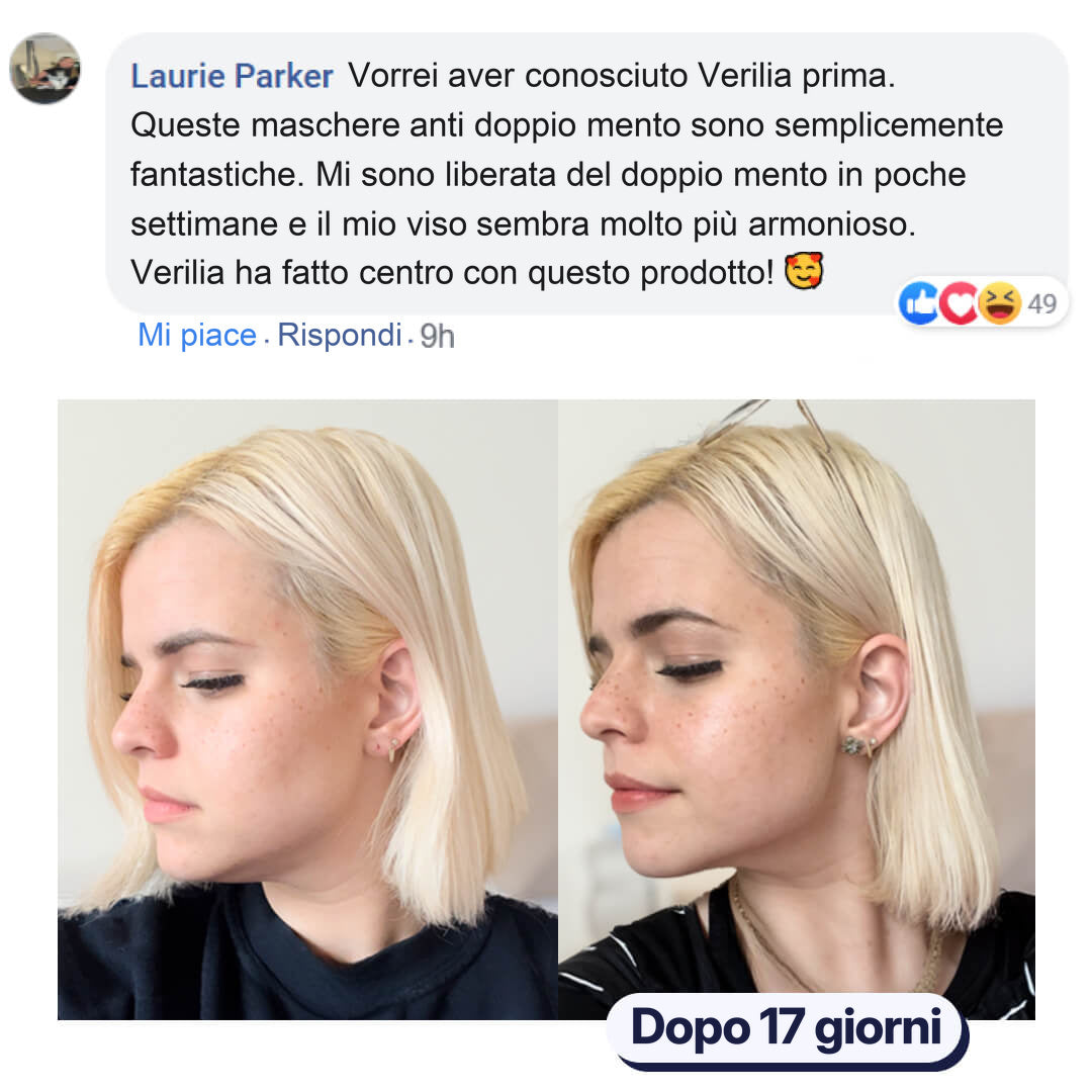 Foto prima e dopo: mento più definito dopo 17 giorni di utilizzo del prodotto.