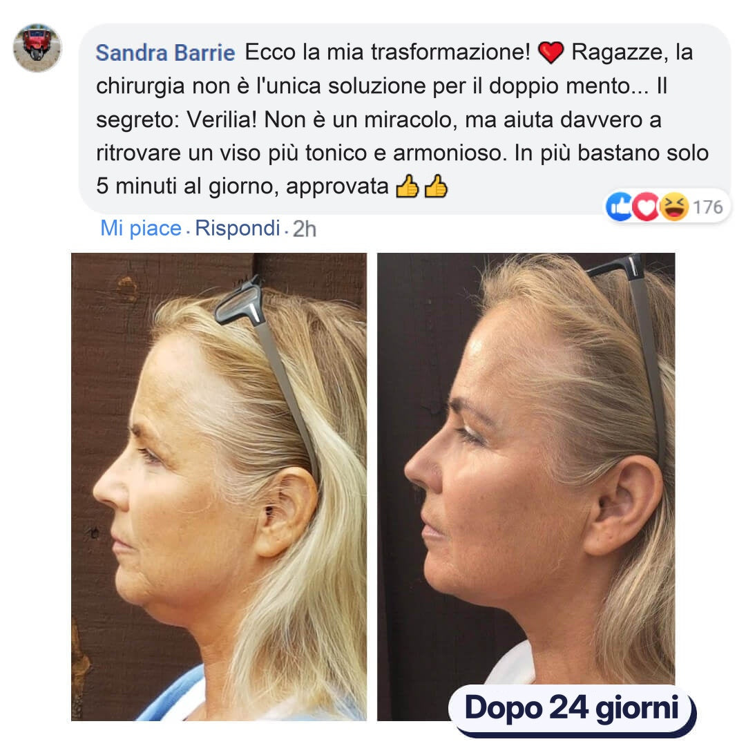 Due foto di profilo: la trasformazione del viso di una donna in 24 giorni.