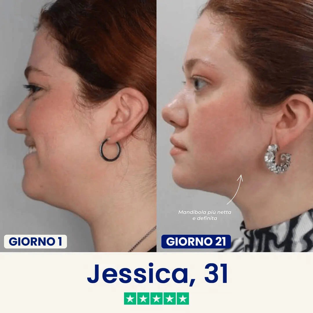 Verilia Lift - Maschera lifting doppio mento