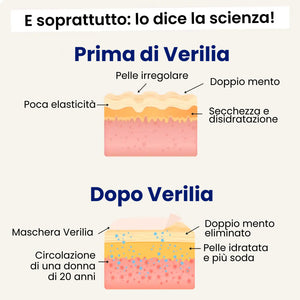 Verilia Lift, Saldi autunnali