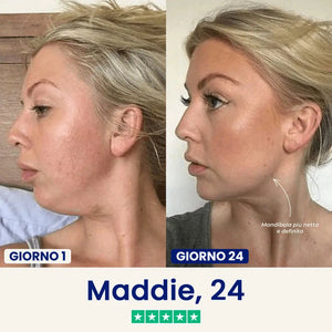 Verilia Lift (nuova versione)